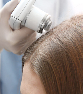 Laser Hair Growth Treatment in Ahmedabad