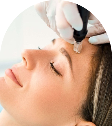 Microneedling Treatment Near Me