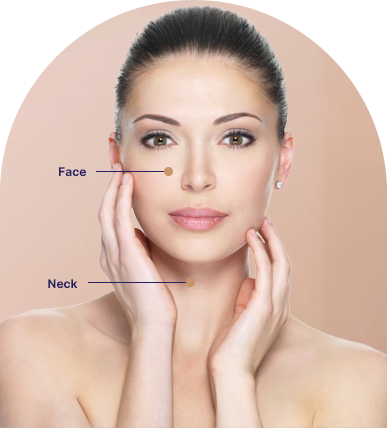 Microneedling in Ahmedabad