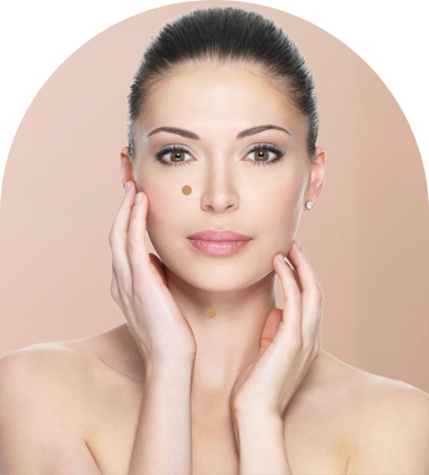 Microneedling in Ahmedabad